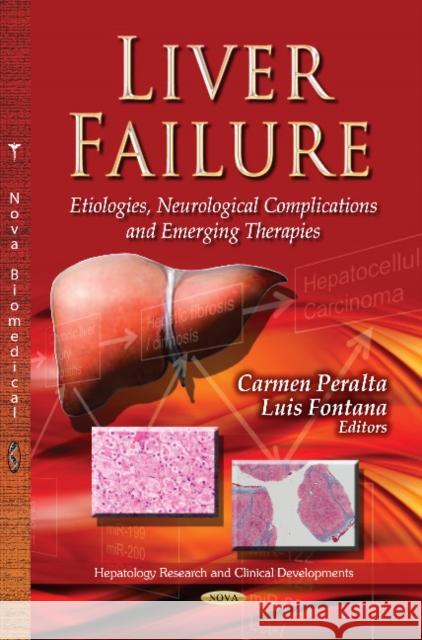 Liver Failure: Etiologies, Neurological Complications & Emerging Therapies Carmen Peralta, Luis Fontana 9781628085075 Nova Science Publishers Inc - książka
