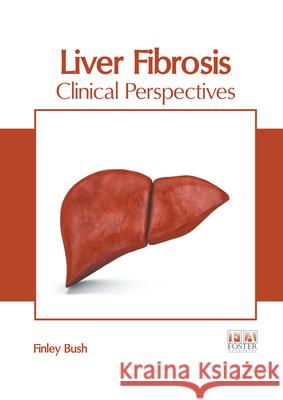 Liver Fibrosis: Clinical Perspectives Finley Bush 9781632429568 Foster Academics - książka