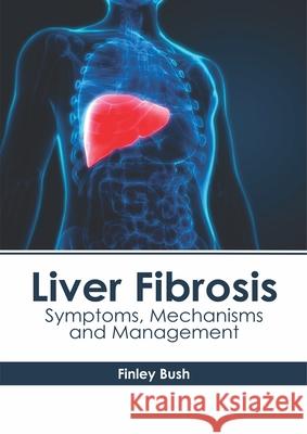 Liver Fibrosis: Symptoms, Mechanisms and Management Finley Bush 9781632416391 Hayle Medical - książka