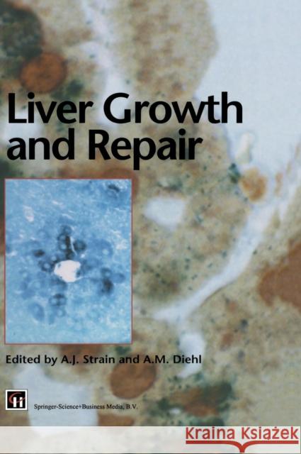Liver Growth and Repair A. J. Strain A. M. Diehl Diehl 9780412712609 Kluwer Academic Publishers - książka