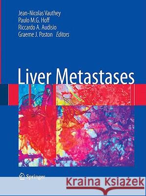 Liver Metastases Riccardo A. Audisio Graeme J. Poston Jean-Nicolas Vauthey 9781846289460 Not Avail - książka