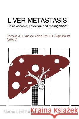 Liver Metastasis: Basic Aspects, Detection and Management Van De Velde, Cornelis 9789400960534 Springer - książka