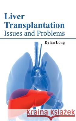 Liver Transplantation: Issues and Problems Dylan Long 9781632422576 Foster Academics - książka
