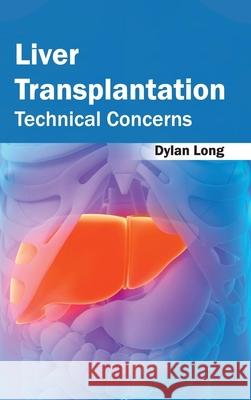 Liver Transplantation: Technical Concerns Dylan Long 9781632422583 Foster Academics - książka