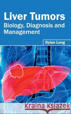 Liver Tumors: Biology, Diagnosis and Management Dylan Long 9781632422590 Foster Academics - książka