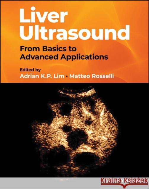 Liver Ultrasound: From Basics to Advanced Applications Lim, Adrian 9781119612599 John Wiley and Sons Ltd - książka