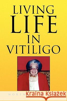 Living Life in Vitiligo Norene L. Willis 9781436348249 Xlibris Corporation - książka