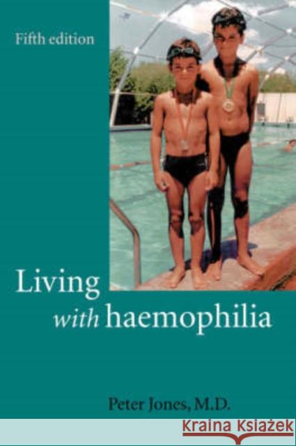 Living with Haemophilia Peter Jones 9780192632296 Oxford University Press, USA - książka