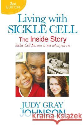 Living With Sickle Cell - The Inside Story: Sickle Cell Disease is Not What You See Judy Gray Johnson 9781535458160 Createspace Independent Publishing Platform - książka