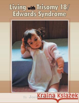 Living with Trisomy 18 / Edwards Syndrome Josie Murrell 9781479793501 Xlibris Corporation - książka