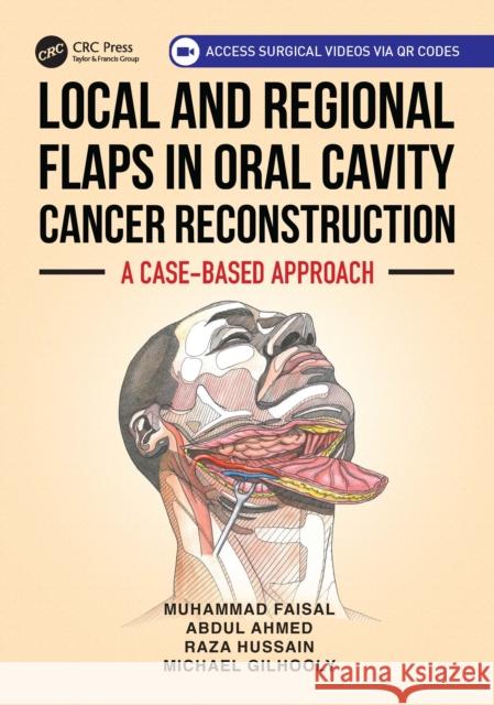 Local and Regional Flaps in Oral Cavity Cancer Reconstruction: A case-based approach Michael Gilhooly 9781032714417 CRC Press - książka