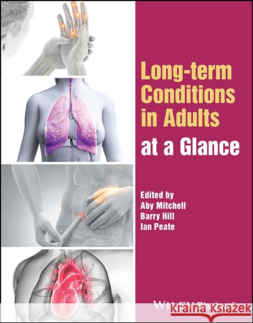 Long-term Conditions in Adults at a Glance Mitchell 9781119875871 John Wiley and Sons Ltd - książka