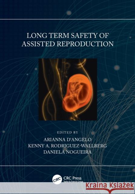 Long Term Safety of Assisted Reproduction Arianna D'Angelo Kenny A. Rodriguez-Wallberg Daniela Nogueira 9780367511203 CRC Press - książka