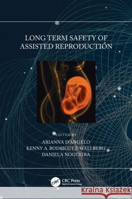 Long Term Safety of Assisted Reproduction Arianna D'Angelo Kenny A. Rodriguez-Wallberg Daniela Nogueira 9780367511234 CRC Press - książka