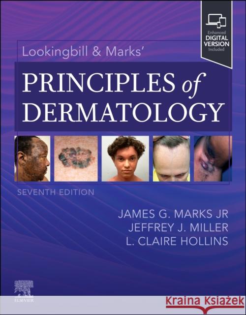 Lookingbill & Marks' Principles of Dermatology James G. Marks Jeffrey J. Miller L. Claire Hollins 9780323934244 Elsevier - książka