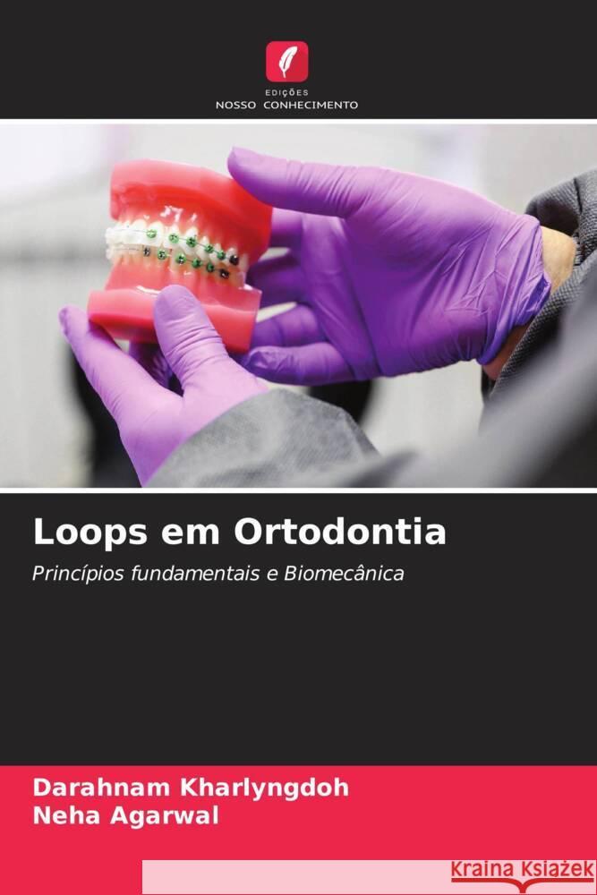 Loops em Ortodontia Kharlyngdoh, Darahnam, Agarwal, Neha 9786205138984 Edições Nosso Conhecimento - książka