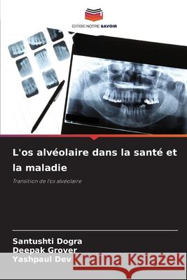 L'os alvéolaire dans la santé et la maladie Dogra, Santushti, Grover, Deepak, Dev, Yashpaul 9786209460265 Editions Notre Savoir - książka
