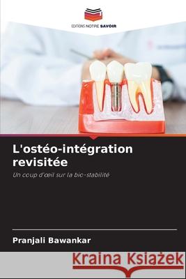 L'ostéo-intégration revisitée Bawankar, Pranjali 9786204159119 Editions Notre Savoir - książka