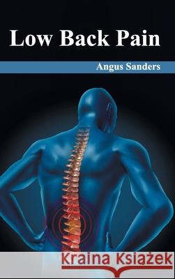Low Back Pain Angus Sanders 9781632422613 Foster Academics - książka