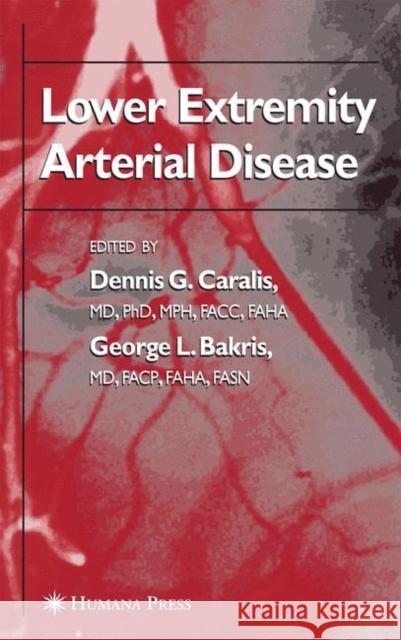 Lower Extremity Arterial Disease Dennis G. Caralis Dennis G. Caralis George L. Bakris 9781588295545 Humana Press - książka