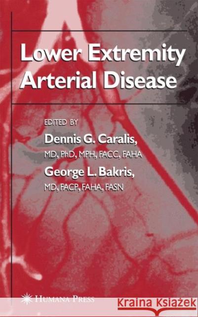 Lower Extremity Arterial Disease Dennis G. Caralis George L. Bakris 9781617376399 Springer - książka