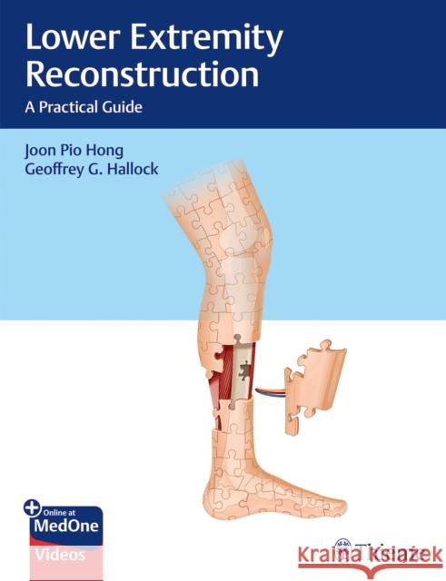 Lower Extremity Reconstruction: A Practical Guide Hong, Joon Pio 9781626238084 Thieme Medical Publishers - książka