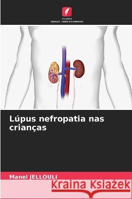 L?pus nefropatia nas crian?as Manel Jellouli 9786205870877 Edicoes Nosso Conhecimento - książka