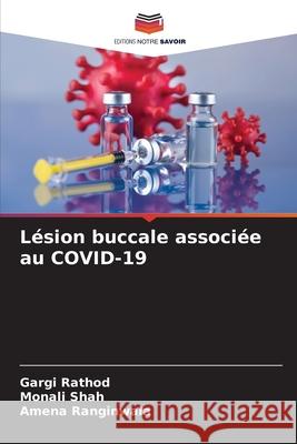 Lésion buccale associée au COVID-19 Rathod, Gargi, Shah, Monali, Ranginwala, Amena 9783639789171 Editions Notre Savoir - książka