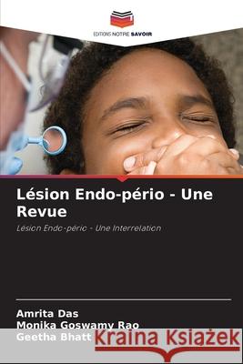 Lésion Endo-pério - Une Revue Das, Amrita 9786204141145 Editions Notre Savoir - książka