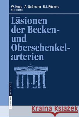 Läsionen Der Becken- Und Oberschenkelarterien Hepp, W. 9783798517165 Steinkopff-Verlag Darmstadt - książka