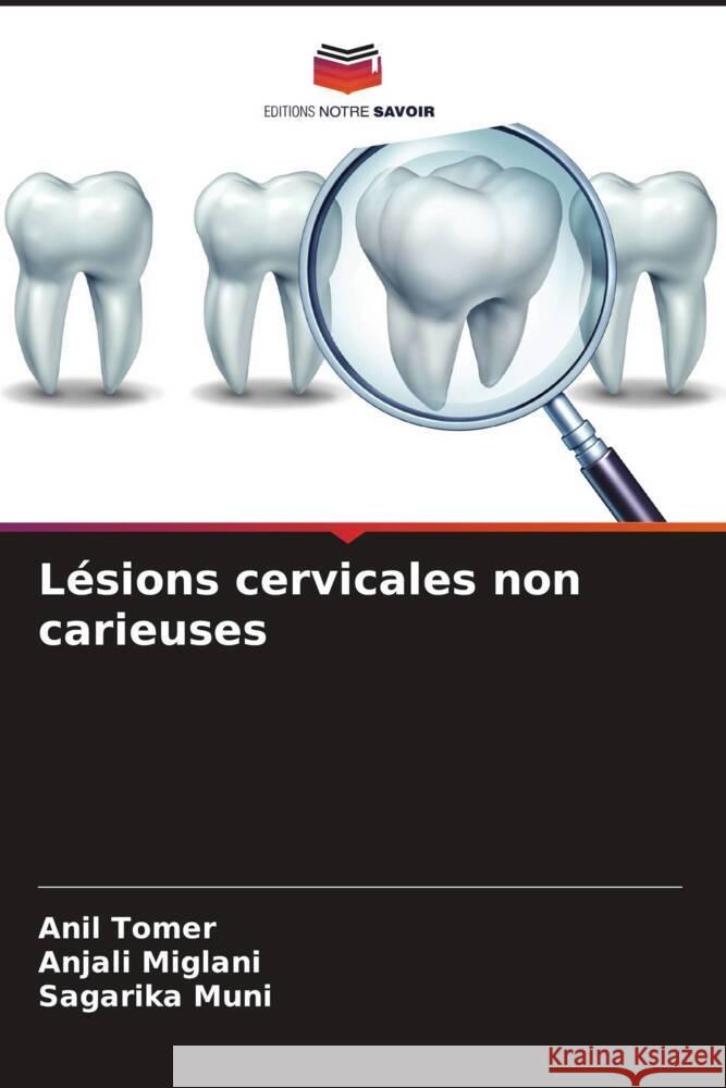 L?sions cervicales non carieuses Anil Tomer Anjali Miglani Sagarika Muni 9786208061951 Editions Notre Savoir - książka