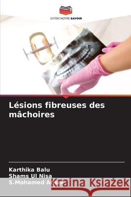 Lésions fibreuses des mâchoires Balu, Karthika, Nisa, Shams Ul, Anser, S.Mohamed 9783330511538 Editions Notre Savoir - książka