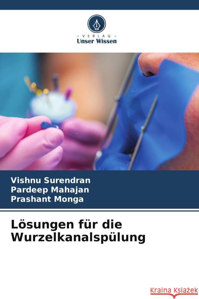 Lösungen für die Wurzelkanalspülung Surendran, Vishnu, Mahajan, Pardeep, Monga, Prashant 9786206302209 Verlag Unser Wissen - książka