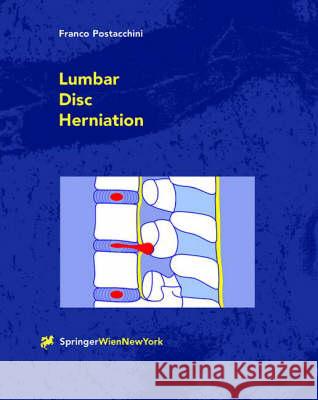 Lumbar Disc Herniation Postacchini, Franco 9783211831182 Springer Vienna - książka