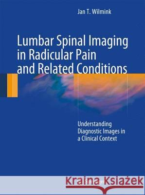 Lumbar Spinal Imaging in Radicular Pain and Related Conditions: Understanding Diagnostic Images in a Clinical Context Wilmink, J. T. 9783642432385 Springer - książka