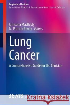 Lung Cancer  9783031384110 Springer International Publishing - książka