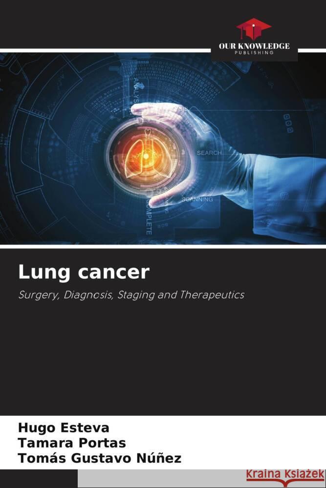 Lung cancer Esteva, Hugo, Portas, Tamara, Núñez, Tomás Gustavo 9786202610803 Our Knowledge Publishing - książka