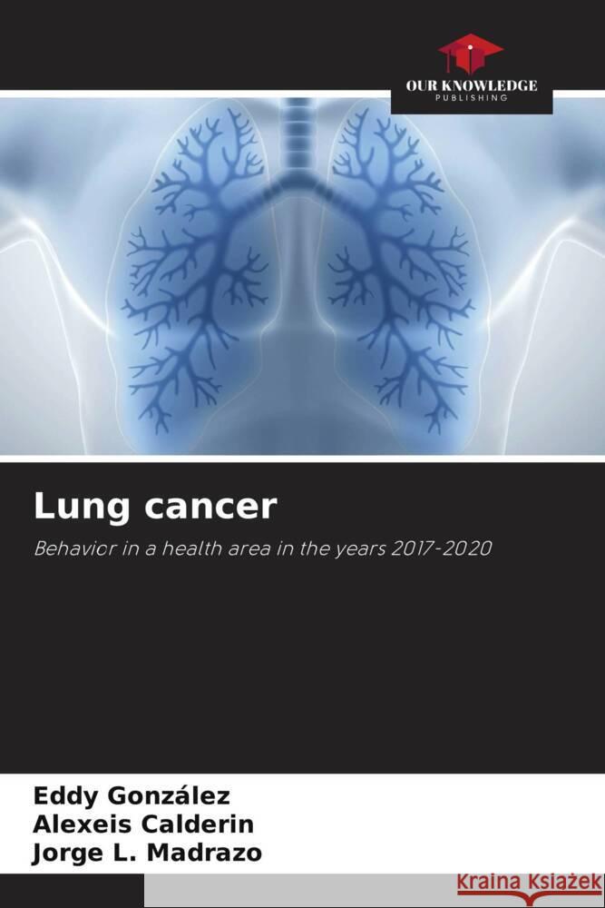 Lung cancer González, Eddy, Calderin, Alexeis, Madrazo, Jorge L. 9786204639819 Our Knowledge Publishing - książka