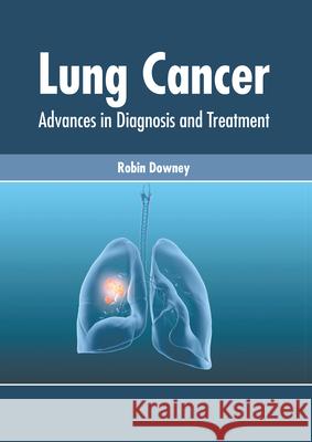 Lung Cancer: Advances in Diagnosis and Treatment Robin Downey 9781632428752 Foster Academics - książka
