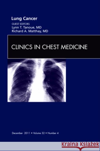 Lung Cancer, an Issue of Clinics in Chest Medicine: Volume 32-4 Tanoue, Lynn T. 9781455779819 W.B. Saunders Company - książka
