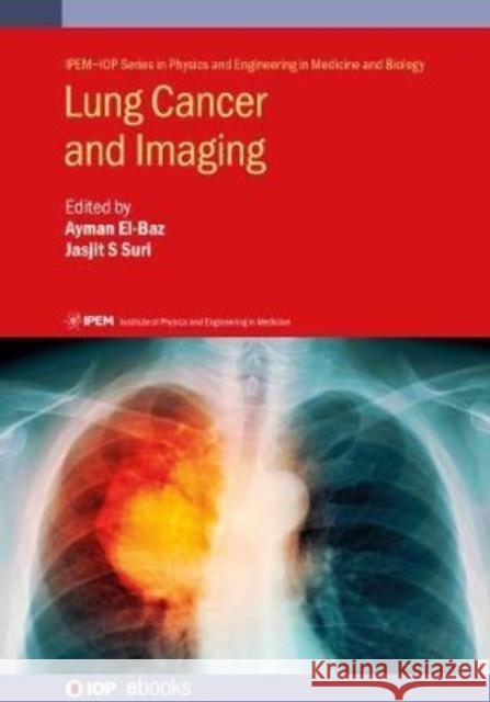 Lung Cancer and Imaging Ayman El-Baz Jasjit S. Suri 9780750325387 IOP Publishing Ltd - książka