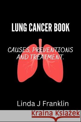 Lung Cancer Book: Causes, preventions and treatment Linda J Franklin 9798354169610 Independently Published - książka