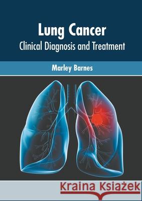 Lung Cancer: Clinical Diagnosis and Treatment Marley Barnes 9781639873470 Murphy & Moore Publishing - książka