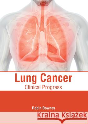 Lung Cancer: Clinical Progress Robin Downey 9781632418357 Hayle Medical - książka