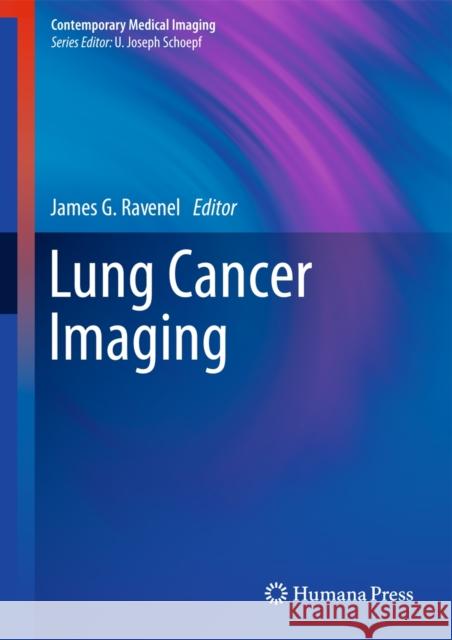 Lung Cancer Imaging James Ravenel 9781607616191 Humana Press - książka