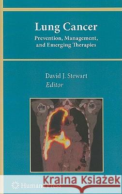 Lung Cancer:: Prevention, Management, and Emerging Therapies Stewart, David J. 9781607615231 Humana Press - książka