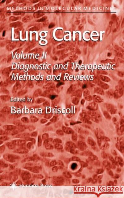 Lung Cancer: Volume 2: Diagnostic and Therapeutic Methods and Reviews Driscoll, Barbara 9780896039209 Humana Press - książka