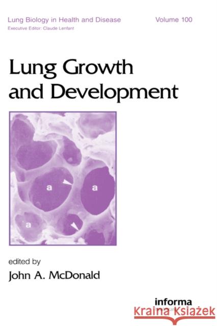 Lung Growth and Development McDonald                                 John A. McDonald 9780824797720 Informa Healthcare - książka