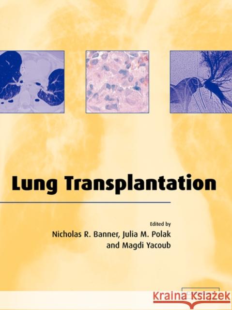Lung Transplantation Nicholas R. Banner Nicholas R. Banner Julia M. Polak 9780521036771 Cambridge University Press - książka
