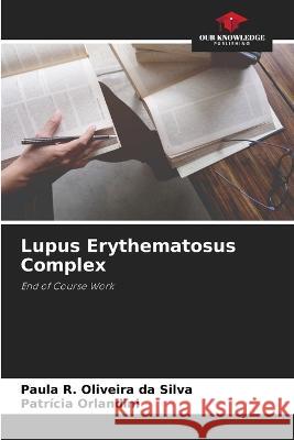 Lupus Erythematosus Complex Paula R Oliveira Da Silva Patricia Orlandini  9786206115533 Our Knowledge Publishing - książka